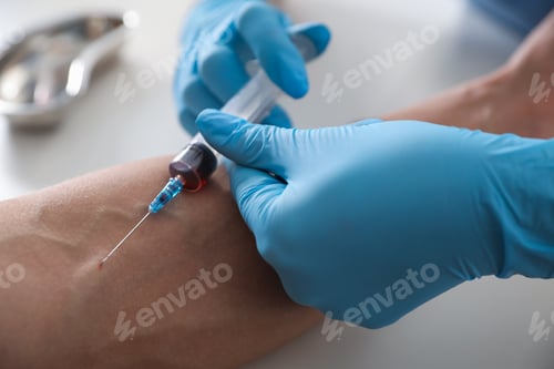 Preview: Nurse drawing man's blood sample in clinic, closeup