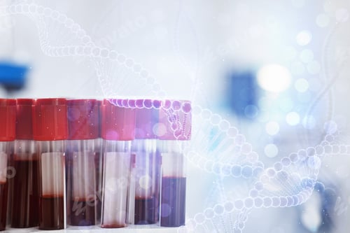 Preview: Biochemistry analysis. Test tubes with blood samples. Double exposure with DNA strands