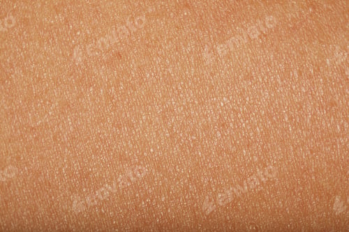 Preview: Texture of normal skin as background, closeup