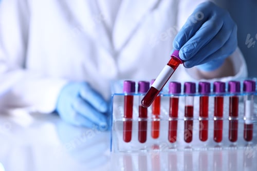 Preview: Laboratory worker with blood samples in test tubes at table indoors, closeup