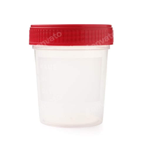 Preview: Urology. Empty container for analysis isolated on white