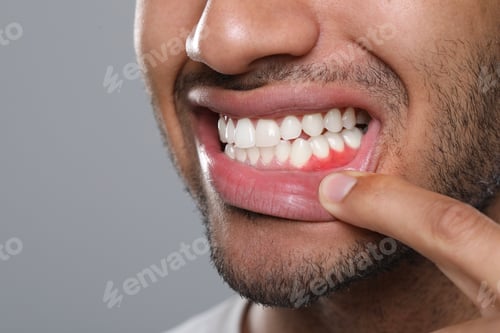 Preview: Man showing inflamed gum on grey background, closeup