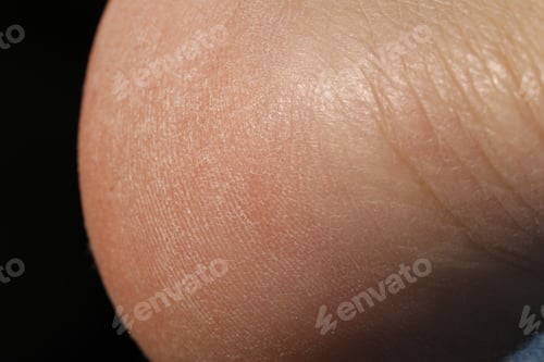 Preview: Man with dry skin on his foot against black background, closeup