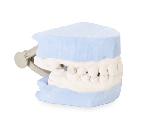Preview: Dental model with gums isolated on white. Cast of teeth