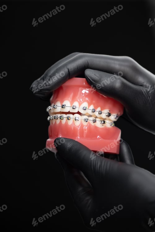 Preview: Doctor orthodontist holding and demonstrating anatomical model of human jaw with metal wire braces b