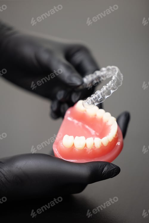 Preview: Transparent dental aligner on jaw model modern invisible orthodontic