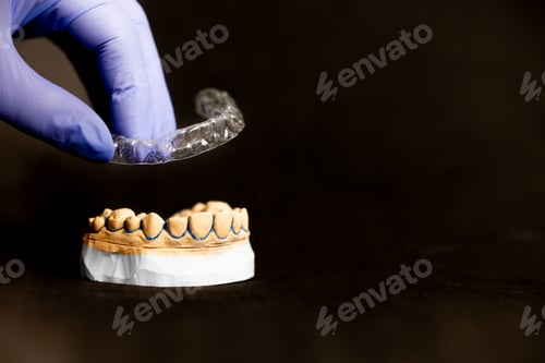Preview: Clear aligner tray on dental model invisible braces orthodontic concept