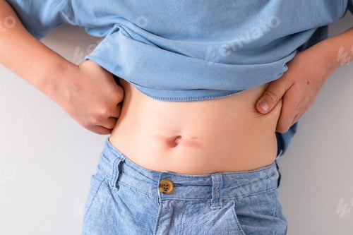 Preview: A child lifts his shirt to reveal his stomach and shows an iron burn near his belly button, experien