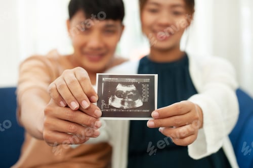 Preview: Close-up View Pregnant Woman Carefully Looking at Ultrasound Film With His Lover Look Happy Family P