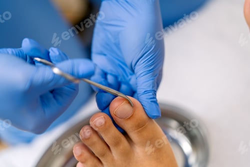 Preview: Podiatrist treating toenail, performing foot care procedure
