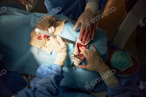 Preview: Surgeons Performing Orthopedic Surgery in Operating Room
