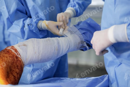 Preview: Medical Professionals Bandaging a Patient's Injured Leg in Surgery