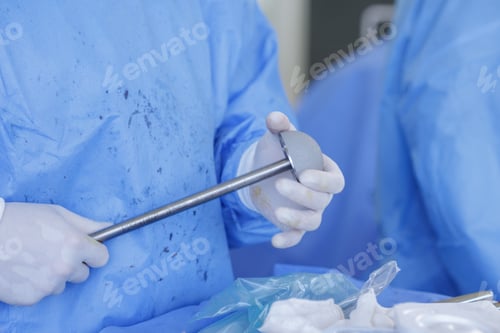 Preview: Surgeon Holding Prosthetic Hip Implant During Orthopedic Procedure