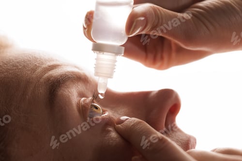 Preview: Applying eye drops close up for dry eye relief and vision care treatment